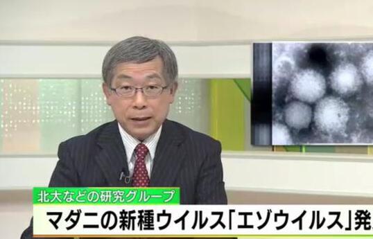 �ձ������ܴ�Ⱦ�����²���,���ж��˸�ȾYezo����